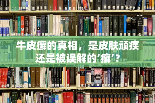 牛皮癣的真相，是皮肤顽疾还是被误解的‘癣’？