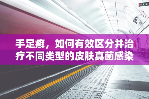 手足癣，如何有效区分并治疗不同类型的皮肤真菌感染？